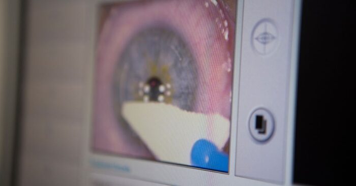 Laser Vision Correction Featured Image
